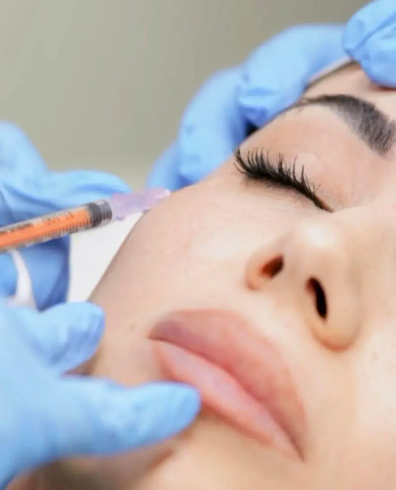 Botox classico per le rughe del viso