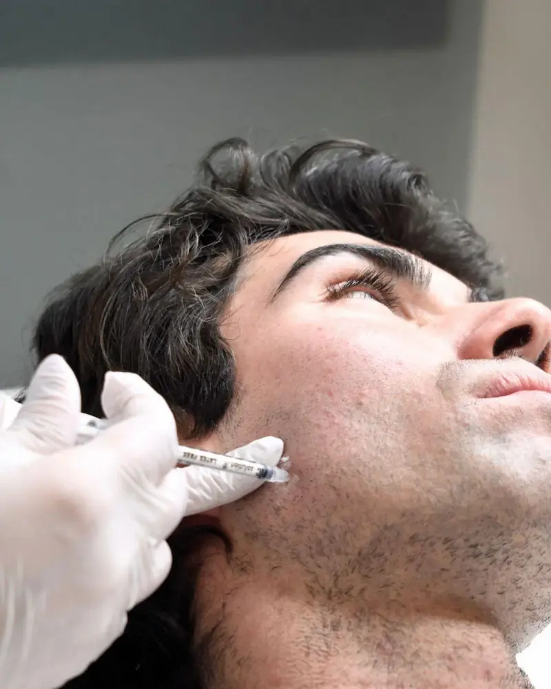 Botox al massetere per l'ovale del viso