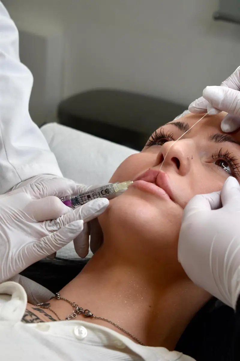 Filler labbra FClips